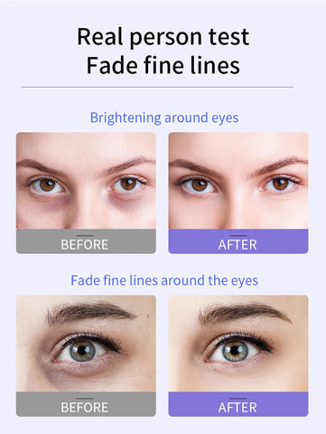 Anti-Wrinkle Eye Cream with Roller Ball – Hydrating & Firming, 20g