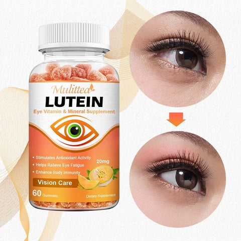 Lutein Gummies – Eye Health & Blue Light Protection, 60pcs