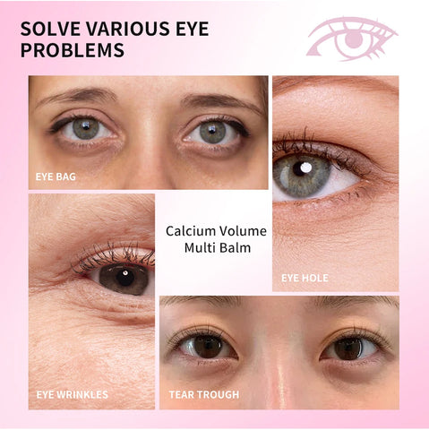 Calcium Collagen Vitamin D Eye Balm – Anti-Aging & Dark Circle, 9g